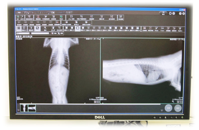 デジタルX線画像診断システム